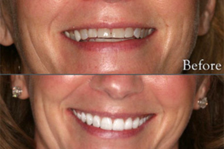 Cosmetic Dentistry in Long Island Call us today